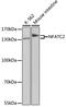 Nuclear Factor Of Activated T Cells 2 antibody, GTX33354, GeneTex, Western Blot image 