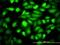 DnaJ Heat Shock Protein Family (Hsp40) Member B6 antibody, H00010049-M01, Novus Biologicals, Immunocytochemistry image 