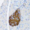 TIMP Metallopeptidase Inhibitor 2 antibody, 16-606, ProSci, Immunohistochemistry paraffin image 