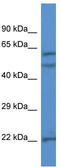 Hpa1 antibody, TA343051, Origene, Western Blot image 