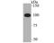 Centromere Protein C antibody, A06766-1, Boster Biological Technology, Western Blot image 
