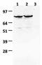 Leucine Rich Repeat Containing G Protein-Coupled Receptor 5 antibody, M00239-Biotin, Boster Biological Technology, Western Blot image 