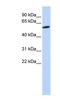 Zinc Finger Protein 454 antibody, NBP1-80197, Novus Biologicals, Western Blot image 