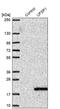 UFM1 Specific Peptidase 1 (Inactive) antibody, PA5-55505, Invitrogen Antibodies, Western Blot image 