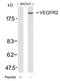 Kinase Insert Domain Receptor antibody, 79-315, ProSci, Western Blot image 
