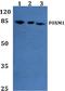 Forkhead Box M1 antibody, A00659-1, Boster Biological Technology, Western Blot image 