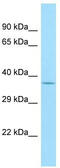 Olfactory Receptor Family 1 Subfamily A Member 2 antibody, TA331997, Origene, Western Blot image 