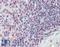 CD70 Molecule antibody, LS-A8812, Lifespan Biosciences, Immunohistochemistry paraffin image 