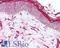 Serpin Family H Member 1 antibody, LS-B2151, Lifespan Biosciences, Immunohistochemistry frozen image 