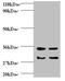 Transforming Growth Factor Alpha antibody, A54053-100, Epigentek, Western Blot image 