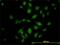 ATPase Secretory Pathway Ca2+ Transporting 1 antibody, H00027032-M01, Novus Biologicals, Immunofluorescence image 