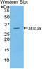 Thyroglobulin antibody, LS-C296645, Lifespan Biosciences, Western Blot image 