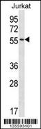 Complement C1r Subcomponent Like antibody, 58-320, ProSci, Western Blot image 