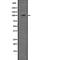 Dicer 1, Ribonuclease III antibody, abx149812, Abbexa, Western Blot image 