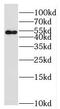 Protein Tyrosine Phosphatase 4A1 antibody, FNab06928, FineTest, Western Blot image 