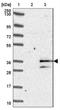 Myeloma Overexpressed antibody, NBP1-80974, Novus Biologicals, Western Blot image 
