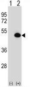 Citrulline--aspartate ligase antibody, AP50278PU-N, Origene, Western Blot image 