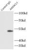 Neutral Cholesterol Ester Hydrolase 1 antibody, FNab00017, FineTest, Immunoprecipitation image 
