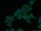 ADP-Ribosylhydrolase Like 2 antibody, 16504-1-AP, Proteintech Group, Immunofluorescence image 