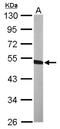 Branched Chain Keto Acid Dehydrogenase Kinase antibody, NBP2-15553, Novus Biologicals, Western Blot image 