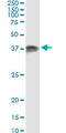 Protein Activator Of Interferon Induced Protein Kinase EIF2AK2 antibody, LS-B5437, Lifespan Biosciences, Immunoprecipitation image 