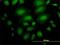 Ankyrin Repeat And Sterile Alpha Motif Domain Containing 1A antibody, H00023294-B01P, Novus Biologicals, Immunofluorescence image 