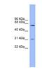 Proprotein Convertase Subtilisin/Kexin Type 2 antibody, NBP1-69146, Novus Biologicals, Western Blot image 