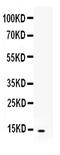 C-X-C Motif Chemokine Ligand 5 antibody, PB9859, Boster Biological Technology, Western Blot image 