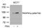 Protein Kinase D1 antibody, GTX50145, GeneTex, Western Blot image 