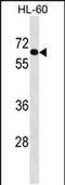 Crystallin Beta-Gamma Domain Containing 2 antibody, PA5-48761, Invitrogen Antibodies, Western Blot image 