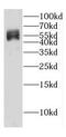 DEP Domain Containing MTOR Interacting Protein antibody, FNab02335, FineTest, Western Blot image 