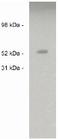 Sulfatase 2 antibody, AP05259PU-N, Origene, Western Blot image 