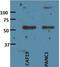 Inhibin Subunit Beta A antibody, NBP2-12009, Novus Biologicals, Western Blot image 