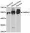 Gamma-Aminobutyric Acid Type A Receptor Alpha3 Subunit antibody, abx125866, Abbexa, Western Blot image 