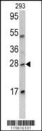 Emerin antibody, LS-B11687, Lifespan Biosciences, Western Blot image 