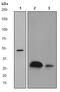 Pim-1 Proto-Oncogene, Serine/Threonine Kinase antibody, ab75776, Abcam, Western Blot image 