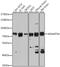 ADAM Metallopeptidase With Thrombospondin Type 1 Motif 4 antibody, 18-689, ProSci, Western Blot image 