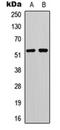 Monoamine Oxidase B antibody, orb378163, Biorbyt, Western Blot image 