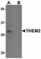 Acyl-CoA Thioesterase 13 antibody, orb94291, Biorbyt, Western Blot image 
