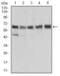 Aldehyde Dehydrogenase 6 Family Member A1 antibody, NBP2-52410, Novus Biologicals, Western Blot image 