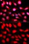 Zinc Finger E-Box Binding Homeobox 1 antibody, GTX33589, GeneTex, Immunocytochemistry image 