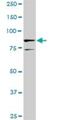 SRY-Box 30 antibody, H00011063-D01P, Novus Biologicals, Western Blot image 