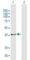 BRCA1/BRCA2-Containing Complex Subunit 3 antibody, H00079184-B01P, Novus Biologicals, Western Blot image 