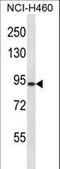 Regulator Of G Protein Signaling 9 antibody, LS-C162584, Lifespan Biosciences, Western Blot image 