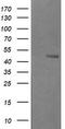 UDP-GlcNAc:BetaGal Beta-1,3-N-Acetylglucosaminyltransferase 2 antibody, LS-C174261, Lifespan Biosciences, Western Blot image 