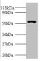 Glucagon Like Peptide 1 Receptor antibody, A53356-100, Epigentek, Western Blot image 