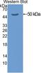 Keratin 20 antibody, LS-C295007, Lifespan Biosciences, Western Blot image 