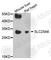 ADP/ATP translocase 3 antibody, A3585, ABclonal Technology, Western Blot image 