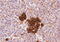 DEAD-Box Helicase 6 antibody, 45-471, ProSci, Immunohistochemistry paraffin image 