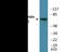 Rabphilin 3A antibody, EKC2114, Boster Biological Technology, Western Blot image 